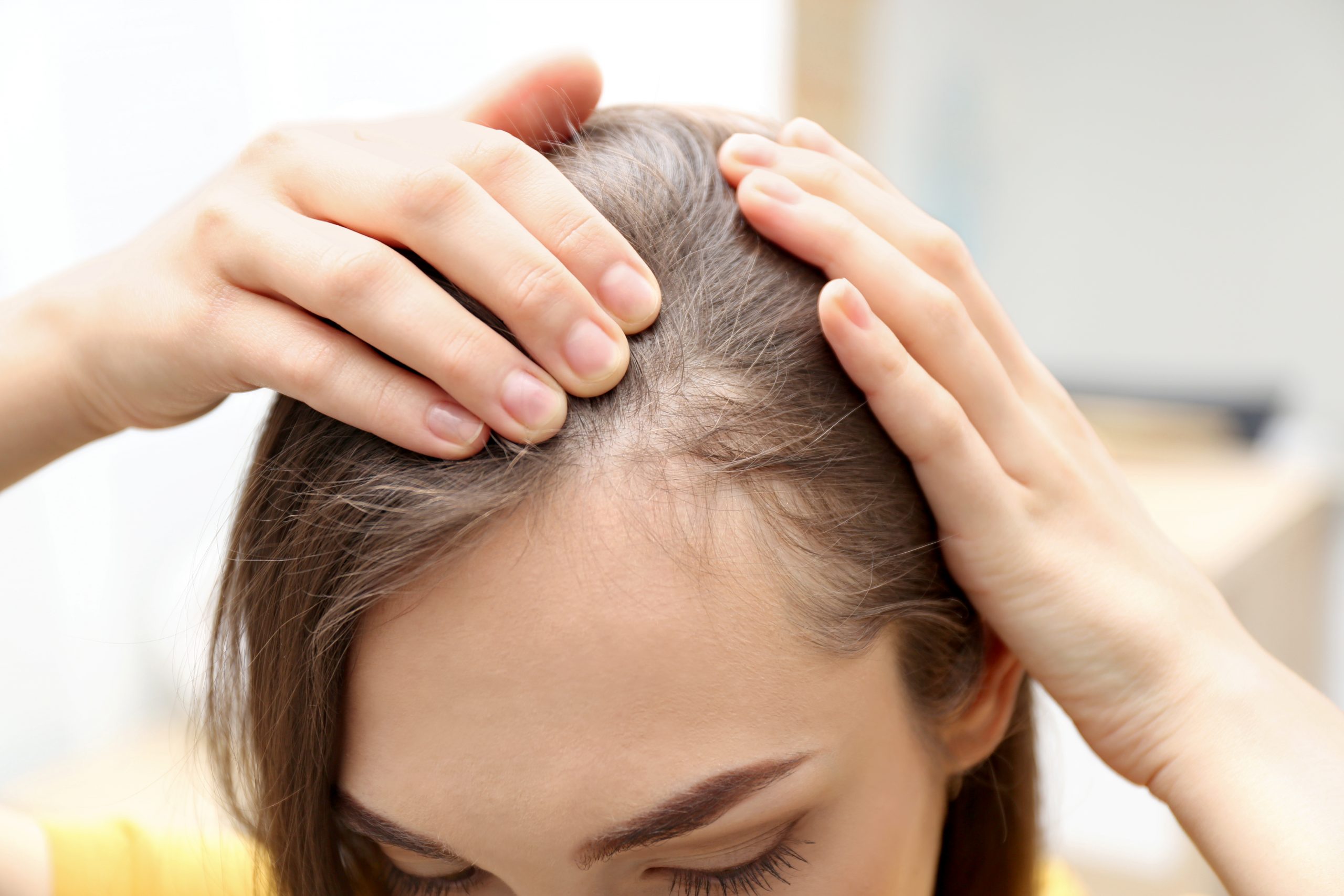 Hair Loss services