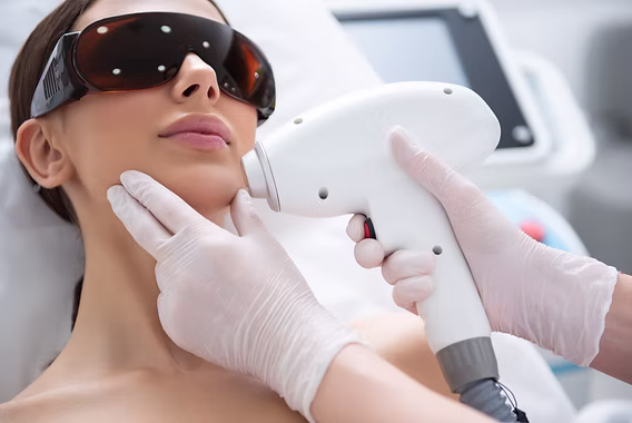 PCOS Laser Hair Removal (Partner) services